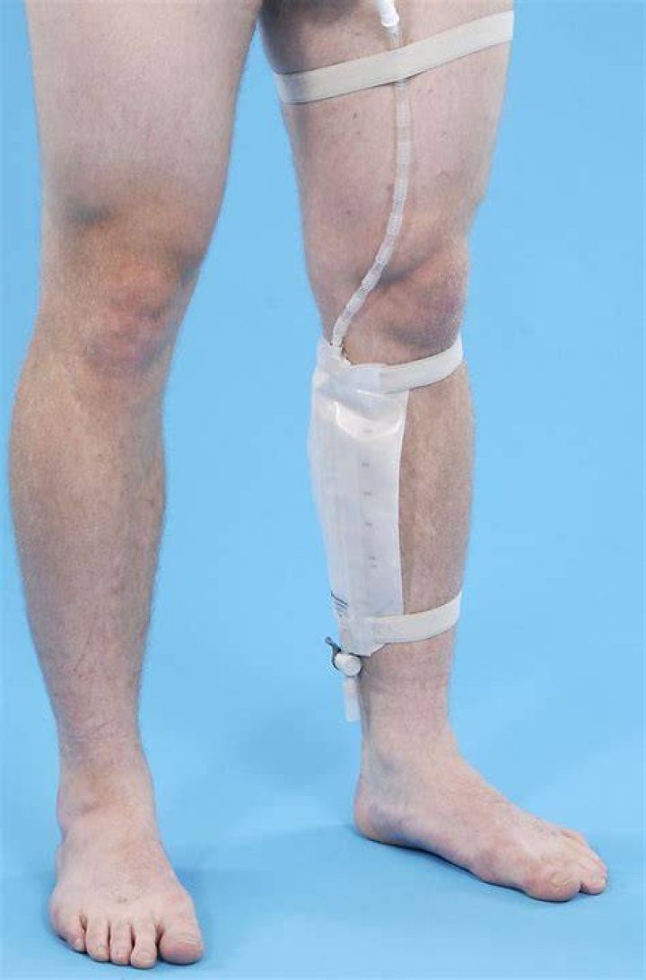 Can I sleep with a catheter leg bag?
