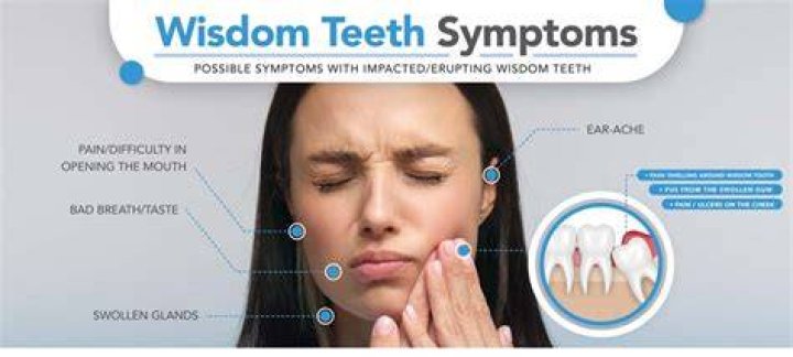 Can wisdom teeth make you sick?