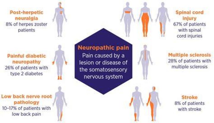 What is neuropathic pain caused by?